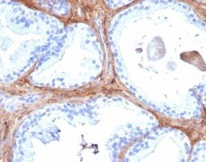 Formalin-fixed, paraffin-embedded human prostate stained with Decorin Mouse Monoclonal Antibody (DCN/6289). HIER: Tris/EDTA, pH9.0, 45min. 2°C: HRP-polymer, 30min. DAB, 5min.