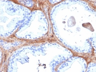 Formalin-fixed, paraffin-embedded human prostate stained with Decorin Mouse Monoclonal Antibody (DCN/6289). HIER: Tris/EDTA, pH9.0, 45min. 2°C: HRP-polymer, 30min. DAB, 5min.