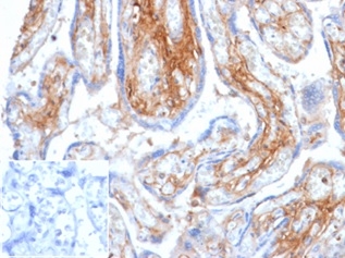 Formalin-fixed, paraffin-embedded human placenta stained with Decorin Mouse Monoclonal Antibody (DCN/6289) at 2ug/ml. Inset: PBS instead of primary antibody; secondary only negative control.