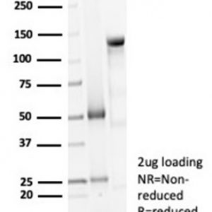 SDS-PAGE Analysis Purified Decorin Rabbit Recombinant Monoclonal Antibody (DCN/7031R). Confirmation of Purity and Integrity of Antibody.
