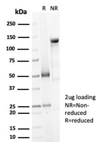 SDS-PAGE Analysis of Purified Decorin Rabbit Recombinant Monoclonal Antibody (DCN/7031R). Confirmation of Purity and Integrity of Antibody.