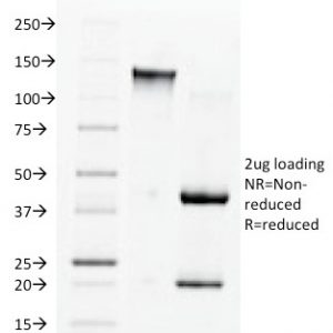 SDS-PAGE Analysis Purified ACE / CD143 Mouse Monoclonal Antibody (9B9). Confirmation of Integrity and Purity of Antibody.