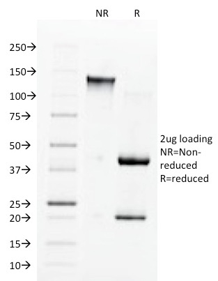 SDS-PAGE Analysis Purified ACE / CD143 Mouse Monoclonal Antibody (9B9). Confirmation of Integrity and Purity of Antibody.