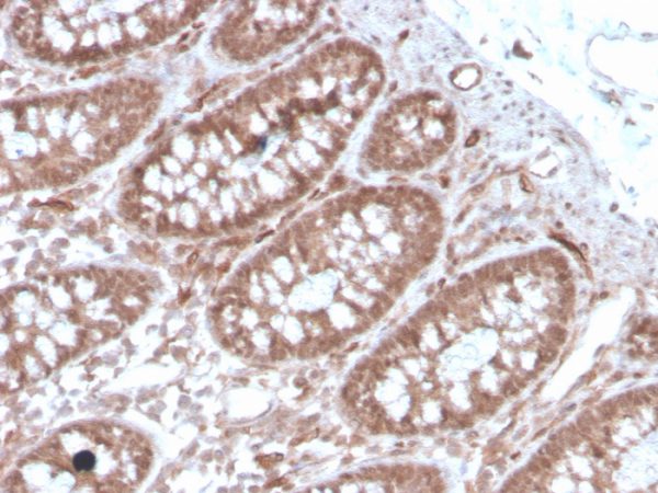 Formalin-fixed, paraffin-embedded human colon stained with ACE / CD143 Mouse Monoclonal Antibody (ACE/3762).