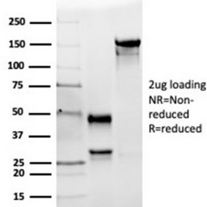 SDS-PAGE Analysis of Purified ACE / CD143 Mouse Monoclonal Antibody (ACE/3764). Confirmation of Integrity and Purity of Antibody.