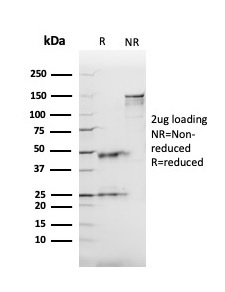 SDS-PAGE Analysis Purified ACE / CD143 Mouse Monoclonal Antibody (ACE/3765). Confirmation of Integrity and Purity of Antibody.