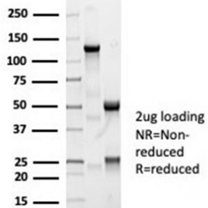 SDS-PAGE Analysis Purified ACE / CD143 Rabbit Monoclonal Antibody (ACE/7004R). Confirmation of Integrity and Purity of Antibody.