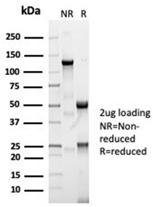 SDS-PAGE Analysis of Purified ACE / CD143 Rabbit Monoclonal Antibody (ACE/7004R). Confirmation of Integrity and Purity of Antibody.