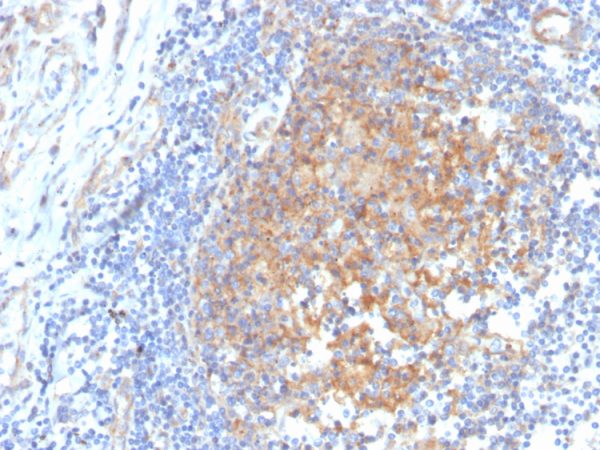 Formalin-fixed, paraffin-embedded human tonsil stained with AKR1C1 Mouse Monoclonal Antibody (CPTC-AKR1C1-2).