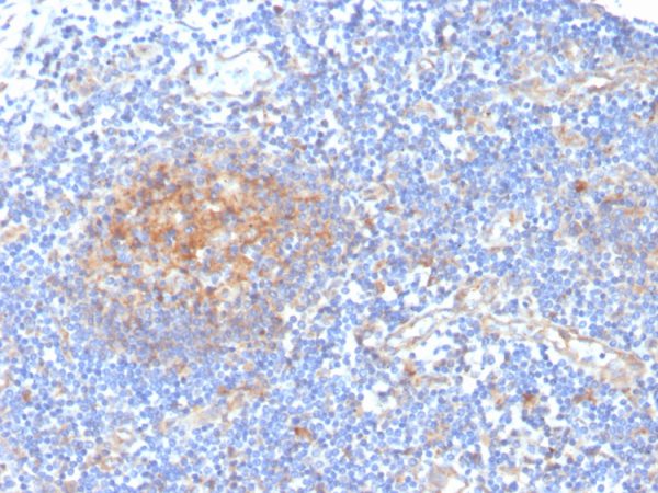 Formalin-fixed, paraffin-embedded human tonsil stained with AKR1C1 Mouse Monoclonal Antibody (CPTC-AKR1C1-2).