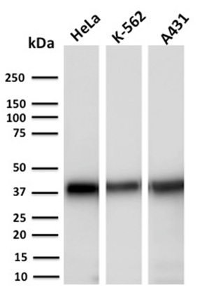 Western Blot Analysis of Human HeLa, K-562 and A431 cell lysates using AKR1C2 Mouse Monoclonal Antibody (CPTC-AKR1C2-1).