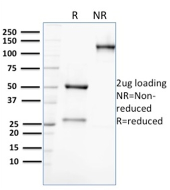 SDS-PAGE Analysis Purified AKR1C2 Mouse Monoclonal Antibody (CPTC-AKR1C2-1). Confirmation of Purity and Integrity of Antibody.