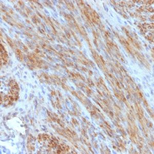 Formalin-fixed, paraffin-embedded human Uterus stained with Desmin Monoclonal Antibody (DES/1711)