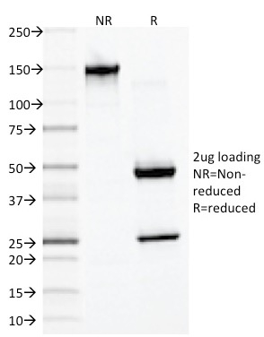 SDS-PAGE Analysis of Purified Desmin Monoclonal Antibody (DES/1711). Confirmation of Purity and Integrity of Antibody