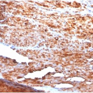 IHC analysis of formalin-fixed, paraffin-embedded human uterus. Stained using rDES/1711 at 2ug/ml in PBS for 30min RT. HIER: Tris/EDTA, pH9.0, 45min. 2 °: HRP-polymer, 30min. DAB, 5min.