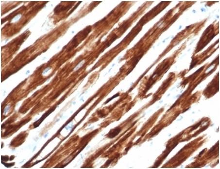 Formalin-fixed, paraffin-embedded human uterus stained with Desmin Recombinant Mouse Monoclonal Antibody (rDES/1711).