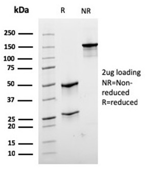 SDS-PAGE Analysis PurifiedDesmin Mouse Monoclonal Antibody (rDES/1711). Confirmation of Purity and Integrity of Antibody.