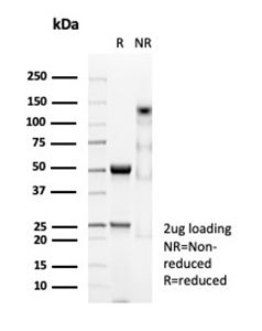 SDS-PAGE Analysis Purified Desmin Mouse Monoclonal Antibody (DES/3255). Confirmation of Purity and Integrity of Antibody.