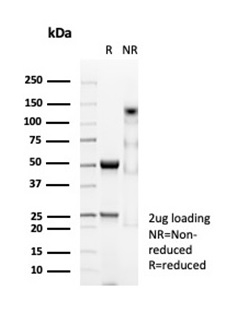 SDS-PAGE Analysis Purified Desmin Mouse Monoclonal Antibody (DES/3255). Confirmation of Purity and Integrity of Antibody.