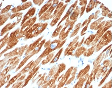 Formalin-fixed, paraffin-embedded human cardiac muscle stained with Desmin Mouse Monoclonal Antibody (DES/3255) at 2ug/ml. HIER: Tris/EDTA, pH9.0, 45min. 2 °: HRP-polymer, 30min. DAB, 5min.