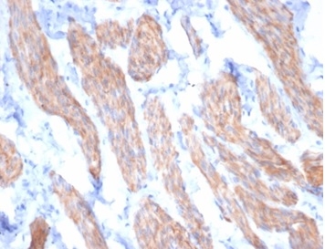 Formalin-fixed, paraffin-embedded horse smooth muscle stained with Desmin Mouse Monoclonal Antibody (DES/3255) at 2ug/ml. HIER: Tris/EDTA, pH9.0, 45min. 2 °: HRP-polymer, 30min. DAB, 5min.
