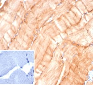 Formalin-fixed, paraffin-embedded human skeletal muscle stained with Desmin Mouse Monoclonal Antibody (DES/4526) at 2ug/ml. Inset: PBS instead of primary antibody; secondary only negative control.