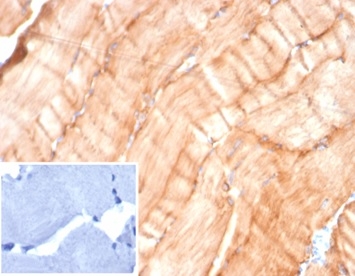 Formalin-fixed, paraffin-embedded human skeletal muscle stained with Desmin Mouse Monoclonal Antibody (DES/4526) at 2ug/ml. Inset: PBS instead of primary antibody; secondary only negative control.