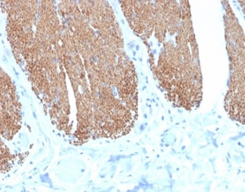 Formalin-fixed, paraffin-embedded human small intestine stained with Desmin Mouse Monoclonal Antibody (DES/4526). HIER: Tris/EDTA, pH9.0, 45min. 2 °: HRP-polymer, 30min. DAB, 5min.