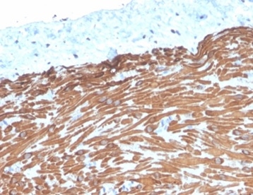 Formalin-fixed, paraffin-embedded human small intestine stained with Desmin Mouse Monoclonal Antibody (DES/4526). HIER: Tris/EDTA, pH9.0, 45min. 2 °: HRP-polymer, 30min. DAB, 5min.