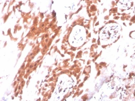 IHC analysis of formalin-fixed, paraffin-embedded human placenta. Staining using IDO2/2640 at 2ug/ml in PBS for 30min RT. HIER: Tris/EDTA, pH9.0, 45min. 2 °: HRP-polymer, 30min. DAB, 5min.