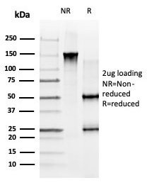SDS-PAGE Analysis of Purified GLIS3 Mouse Monoclonal Antibody (PCRP-GLIS3-1B11). Confirmation of Purity and Integrity of Antibody.
