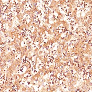 Formalin-fixed, paraffin-embedded human Fetal Liver stained with AFP Mouse Monoclonal Antibody (C3).