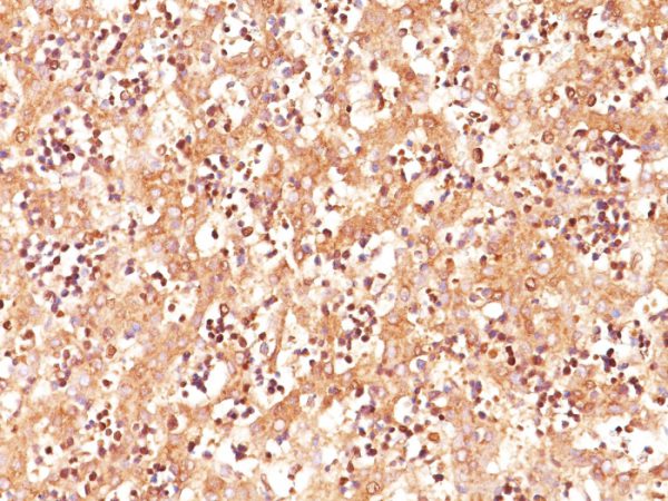 Formalin-fixed, paraffin-embedded human Fetal Liver stained with AFP Mouse Monoclonal Antibody (C3).