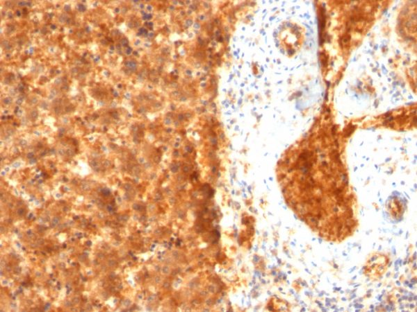 Formalin-fixed, paraffin-embedded human Fetal Liver stained with AFP Monoclonal Antibody (SPM334).