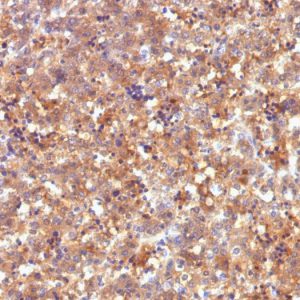Formalin-fixed, paraffin-embedded human Fetal Liver stained with AFP Mouse Monoclonal Antibody (C2).