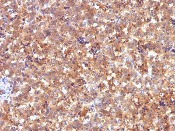 Formalin-fixed, paraffin-embedded human Fetal Liver stained with AFP Mouse Monoclonal Antibody (C2).