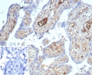 IHC analysis of formalin-fixed, paraffin-embedded human placenta. Cytoplasmic staining using rAFP/7257 at 2ug/ml in PBS for 30min RT. Inset: PBS instead of primary antibody, secondary only negative control.