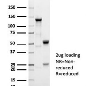 SDS-PAGE Analysis Purified AFP Recombinant Rabbit Monoclonal Antibody (AFP/7007R). Confirmation of Integrity and Purity of Antibody.