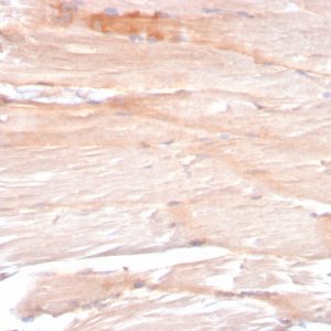 Formalin-fixed, paraffin-embedded human skeletal muscle stained with Dystrophin Monospecific Mouse Monoclonal Antibody (DMD/3241).