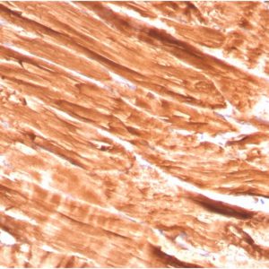 Formalin-fixed, paraffin-embedded human Skeletal Muscle stained with Dystrophin Monospecific Mouse Monoclonal Antibody (DMD/3242).