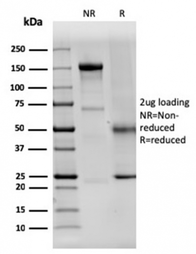 SDS-PAGE Analysis Purified Dystrophin Monospecific Mouse Monoclonal Antibody (DMD/3242). Confirmation of Purity and Integrity of Antibody.
