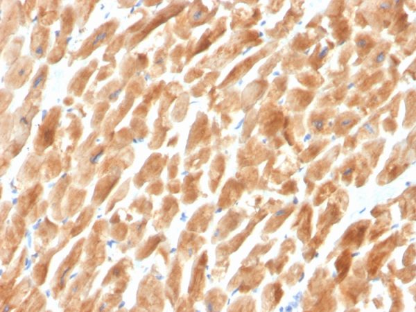 Formalin-fixed, paraffin-embedded human cardiac muscle stained with Dystrophin Monospecific Mouse Monoclonal Antibody (DMD/3242).