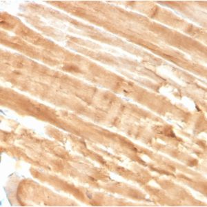 Formalin-fixed, paraffin-embedded human Skeletal Muscle stained with Dystrophin Monospecific Mouse Monoclonal Antibody (DMD/3244)