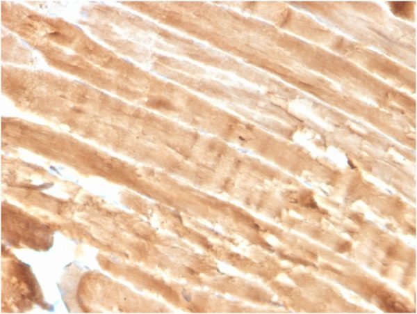 Formalin-fixed, paraffin-embedded human Skeletal Muscle stained with Dystrophin Monospecific Mouse Monoclonal Antibody (DMD/3244)
