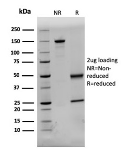 SDS-PAGE Analysis Purified Dystrophin Monospecific Mouse Monoclonal Antibody (DMD/3244). Confirmation of Purity and Integrity of Antibody.