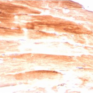 Formalin-fixed, paraffin-embedded human Skeletal Muscle stained with Dystrophin Monospecific Mouse Monoclonal Antibody (DMD/3245).
