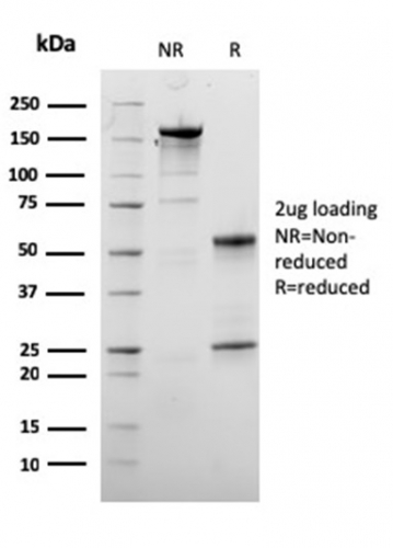 SDS-PAGE Analysis Purified Dystrophin Monospecific Mouse Monoclonal Antibody (DMD/3245). Confirmation of Purity and Integrity of Antibody.