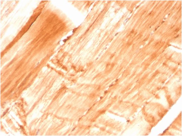 Formalin-fixed, paraffin-embedded human skeletal muscle stained with Dystrophin Monospecific Mouse Monoclonal Antibody (DMD/3677).