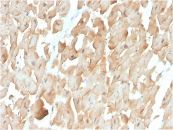 Formalin-fixed, paraffin-embedded human skeletal muscle stained with Dystrophin Monospecific Mouse Monoclonal Antibody (DMD/3677).