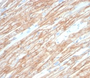 Formalin-fixed, paraffin-embedded human heart muscle stained with Dystrophin Monospecific Mouse Monoclonal Antibody (DMD/6270). HIER: Tris/EDTA, pH9.0, 45min. 2 °: HRP-polymer, 30min. DAB, 5min.